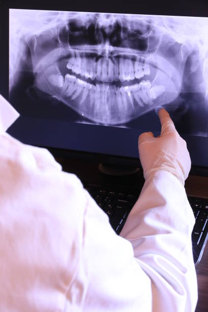 Best Emergency Treatment for Dental Infections or Abscesses in Piedmont, AL